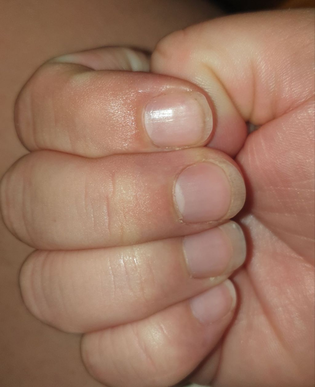 ¿Uñas frágiles? ¿Cómo puedes&nbsp;evitarlo?